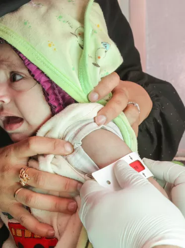 On 27 December 2020, 7-month-old Rawabi Mutahar Ahmed Hassan has her mid-upper arm circumference (MUAC) measured to determine if she is acutely malnourished, at UNICEF-supported Al-Sabeen Hospital in Sana’a, Yemen.