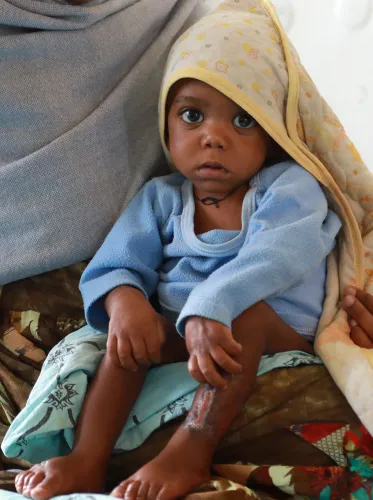 © UNICEF/UN0539132/Leul Kinfu